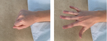 Hand exercise: a) clenched fist; b) splayed fingers