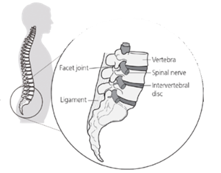 Diagram of the bottom of a spine, labelled: Facet joint, Ligament, Vertebra, Spinal nerve, Intervertebral disc