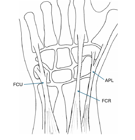 Palm of right hand/ wrist