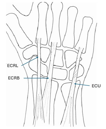 Back of right hand/ wrist