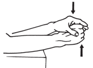 Abductor pollicis longus (APL)
