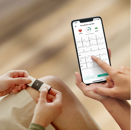 The Kardia app on a phone showing ECG being recorded
