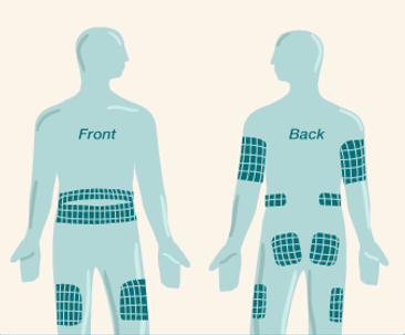 Diagram of a human figure showing padded grid areas on the front and back of the body, including lower back, thighs, hips, and arms, indicating zones of support or protection.