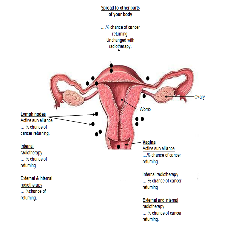 Diagram of the female reproductive system showing the womb, ovaries, vagina, and nearby lymph nodes, with text noting cancer spread and recurrence risk under different radiotherapy options.