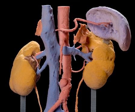 3D print of kidneys