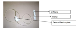 A Fresenius Freka Direct Jejunostomy Tube, labelled: enfit end, clamp, external fixation plate