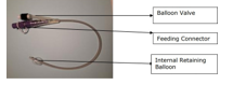 A Silastic Foley Balloon Retained Direct Jejunostomy Tube, labelled: Balloon valve, Feeding connector, Internal Retaining Balloon