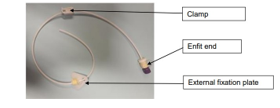 A Vygon Direct Jejunal tube, labelled: clamp, enfit end, external fixation plate