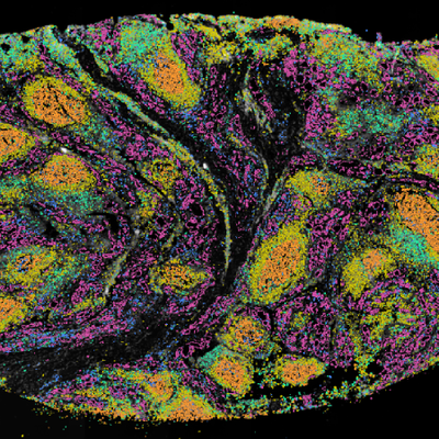 A visual representation of cells in the thyroid gland, a roughly oval shape consisting of many small coloured dots on a black background