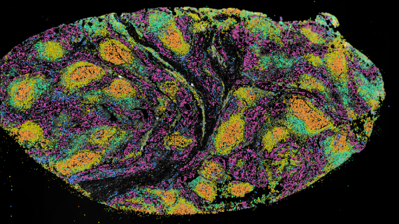 A visual representation of cells in the thyroid gland, a roughly oval shape consisting of many small coloured dots on a black background