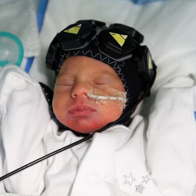 Baby Aaliyah - The fUSiON Study