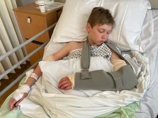 A boy lying asleep in a hospital bed with his arm in a huge plaster and sling