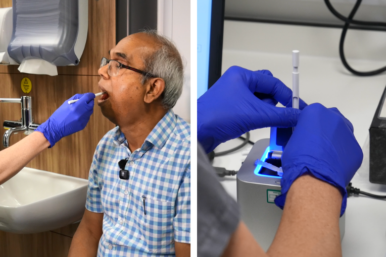 Patient Ashraf Ali has a cheek swab at the new minor stroke clinic at the Queen’s Medical Centre in Nottingham (with credit Joseph Raynor/Nottingham Post)