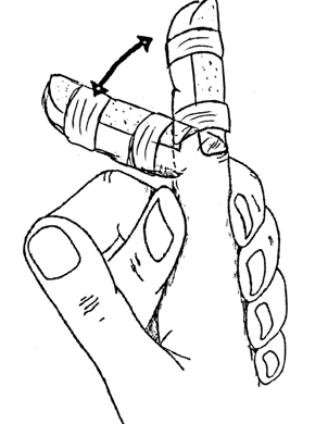 Illustration of right index finger with a splint on that is supported with the left hand with an arrow to show how to move the index finger
