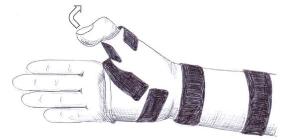 Illustration of a hand in a splint carrying out a thumb exercise