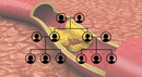 Familial Hypercholesterolaemia Genomic Community of Practice