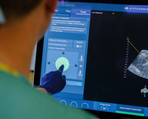 A male doctor wearing a purple glove pointing at a machine and green sphere, showing the ultrasound waves being absorbed into the tumour