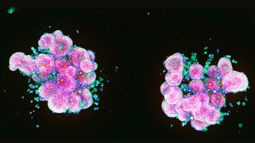 Two pink and green clusters of cells on a black background