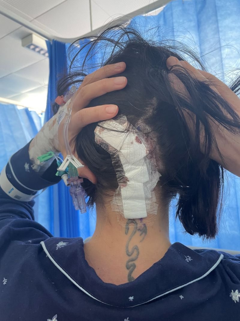 Lydia Griffin post op 800 x 1067