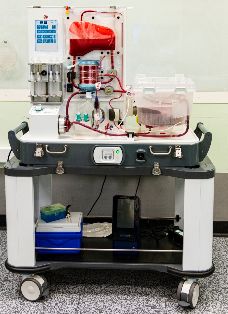 Liver being perfused on perfusion machine