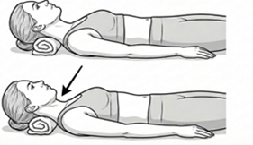 Chin tuck exercise, lying on the back and gently drawing the chin toward the chest while keeping the head on the surface.