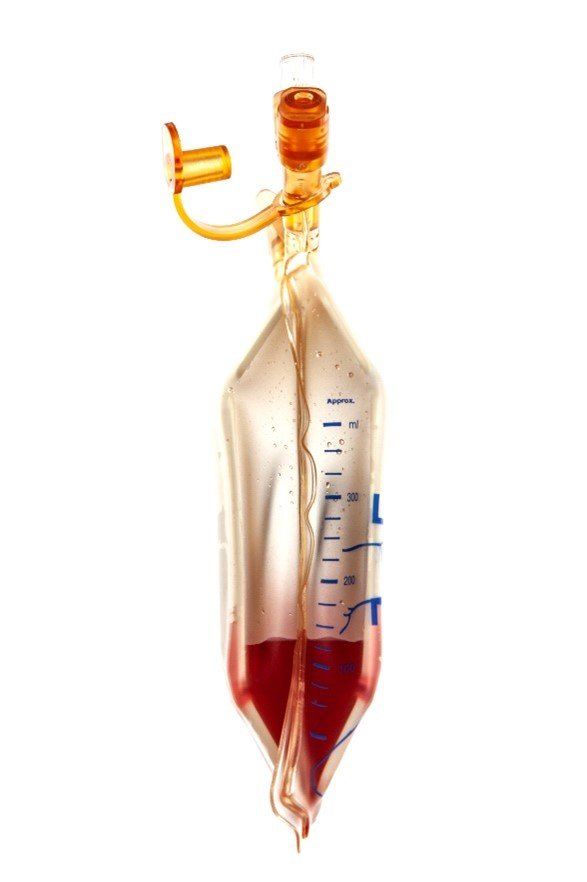 Reservoir is not fully expanded