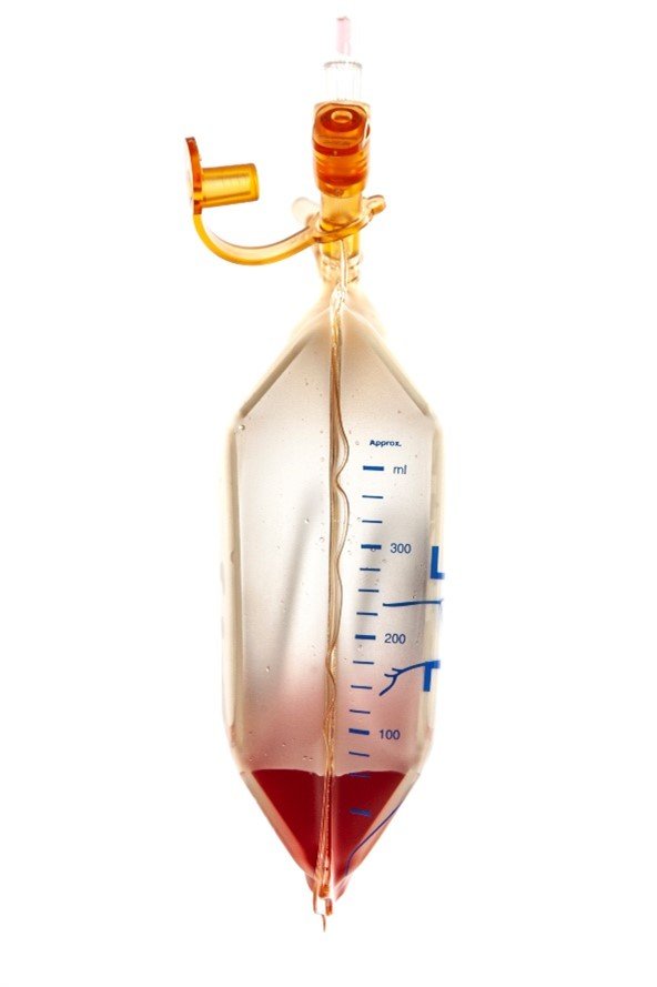 Fully expanded Reservoir