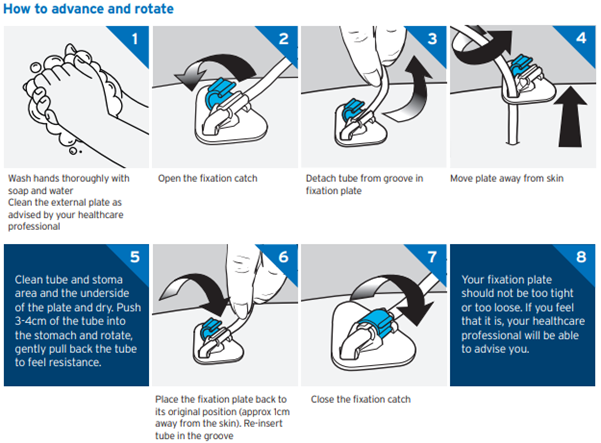 how to advance and rotate