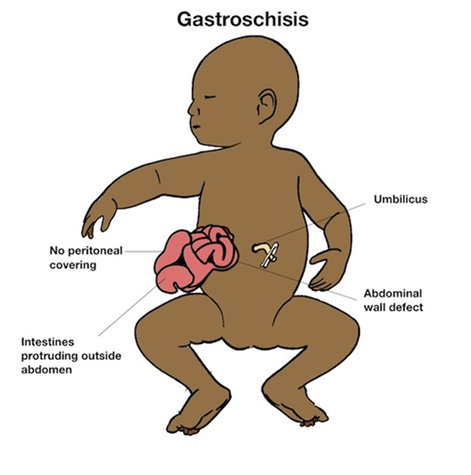 abdominal outside