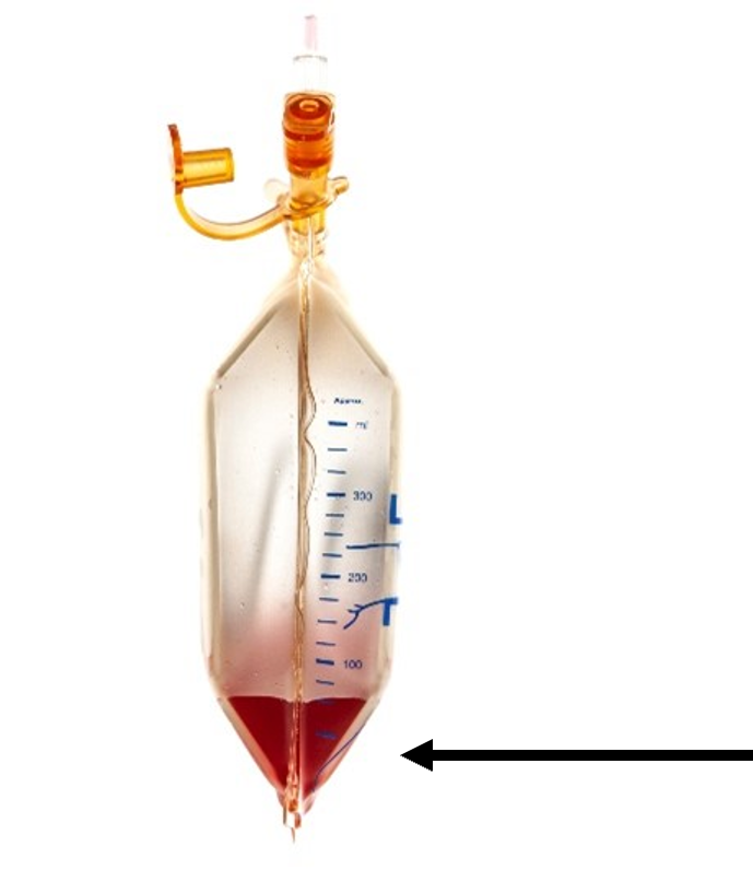 Clear laboratory separation funnel with blue volume markings, containing a small amount of red liquid settled at the pointed bottom. An amber-colored stopcock and side valve are attached at the top, isolated against a white background, with a black arrow.