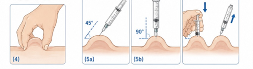 Four-step illustration showing how to pinch the skin, insert a syringe at 45° or 90°, inject the medication, and remove the needle.