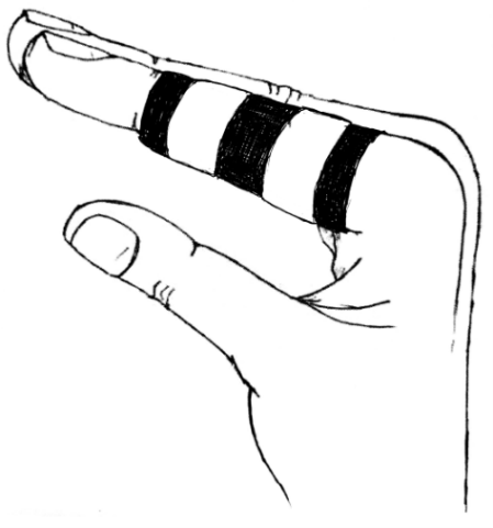 Finger held straight with three tape strips securing a splint along the top of the finger.