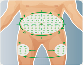 Diagram showing rotation of subcutaneous injection sites across the abdomen and thighs.