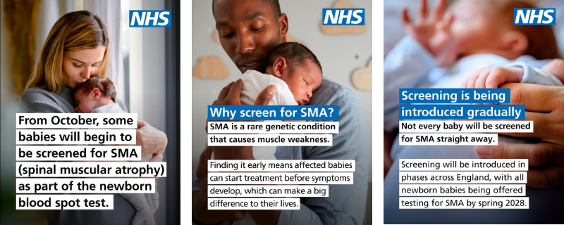 SMA Screening in England