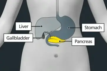 Diagram of organs within the body, highlighting the pancreas in yellow. Labelled: liver, stomach, gallbladder, pancreas