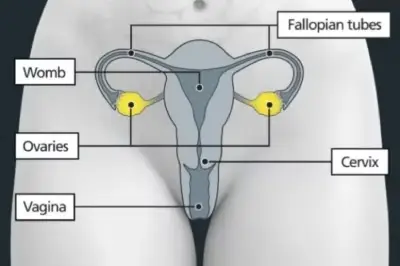 Diagram of a woman's reproductive organs with the ovaries highlighted in yellow. Labelled: Fallopian tubes, womb, ovaries, cervix, vagina