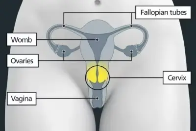 Diagram of a woman's reproductive organs with the cervix highlighted in yellow. Labelled: Fallopian tubes, womb, ovaries, cervix, vagina