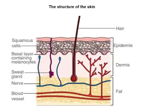 A diagram showing the structure of the skin, labelled: hair, squamous cells, basal layer containing melanocytes, sweat gland, nerve, blood vessel, epidermis, dermis, fat