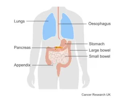 Diagram of the anatomy, labelled: lungs, oesophagus, pancreas, stomach, large bowel, small bowel, appendix