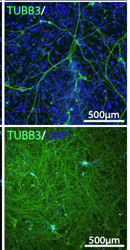 Image showing staining of a protein called TUBB3 which is a marker for neurons.