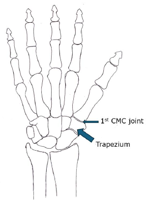 Skeleton hand - highlighting Trapezium and first CMC joint