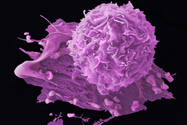 Breast cancer cells
