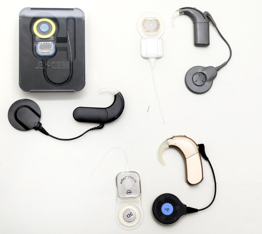 Types Of Hearing Implants CUH
