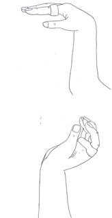 Wrist tenodesis exercise with fingers relaxed