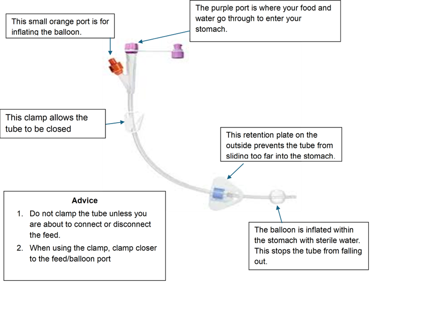 feeding tube