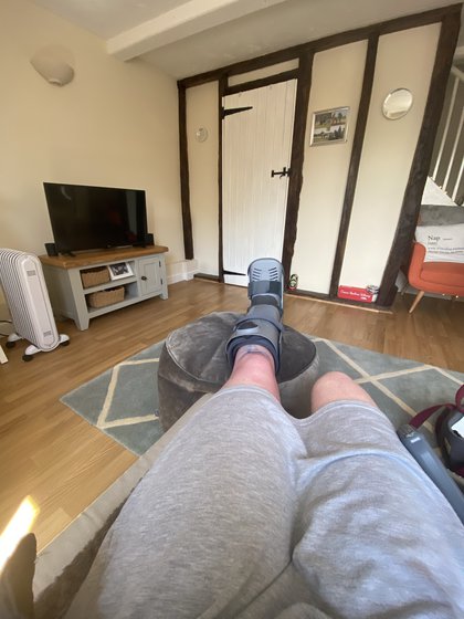 Photograph of Rosie's leg in a support, resting elevated.