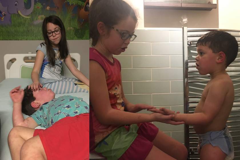 A photo of a little boy lying on a hospital bed with a red rash on his body. His sister is stroking his forehead. The other photo is of a young girl with long brown hair putting cream on her little brother's arm.  he is a toddler and is gazing up at her