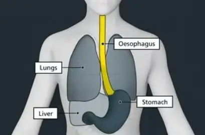 Diagram of parts of the anatomy, labelled: oesophagus, lungs, liver, stomach
