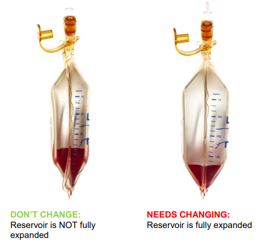 Two medical drainage reservoirs side by side: left partially filled and not expanded (green “don’t change”), right fully expanded with fluid (red “needs changing”).