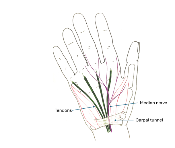 Illustration of hand with the tendons labelled on the left and the median nerve and carpal tunnel labelled on the right